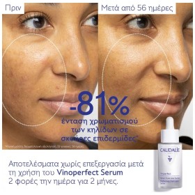 Preview 5 of Caudalie Vinoperfect Serum Eclat Anti-taches Ορός Λάμψης Κατά των Κηλίδων 30ml